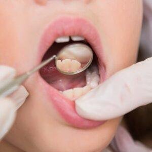 pediatric-dentist