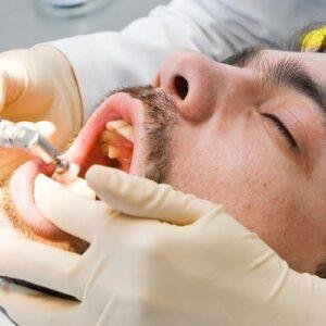 sedation-dentistry