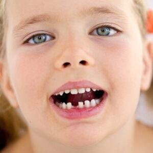 child-knocks-out-a-tooth
