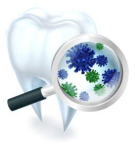 Bad Breath