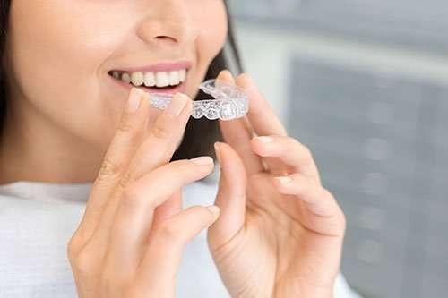 invisible-braces-services-in-Richmond-Hill