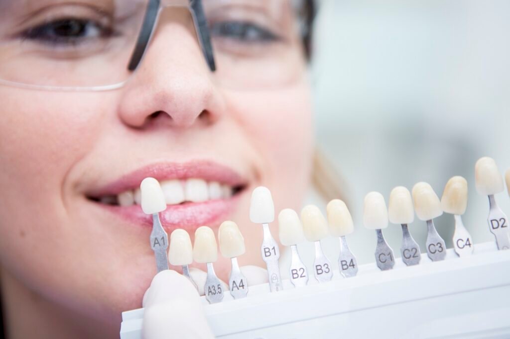 Laser teeth whitening