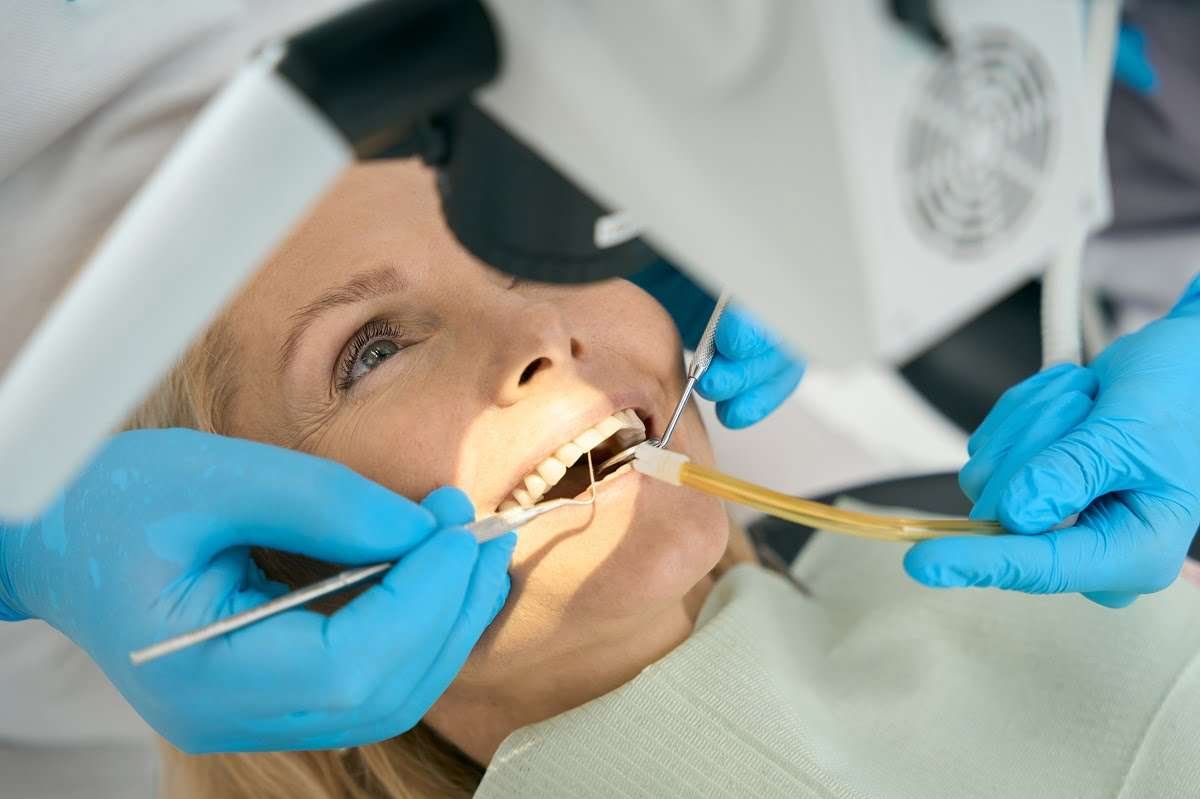 Teeth Filling