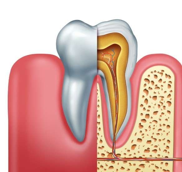 Root canal recovery time