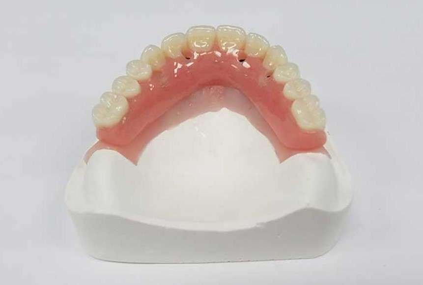 Hybrid Denture Cost