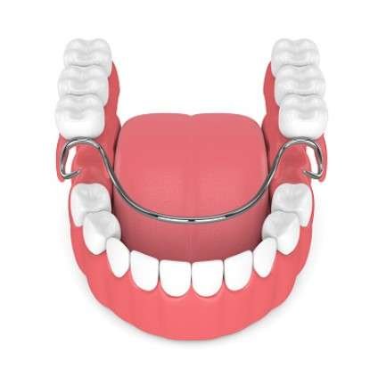 what are dentures made of