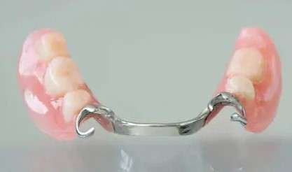 Partial Dentures Pictures
