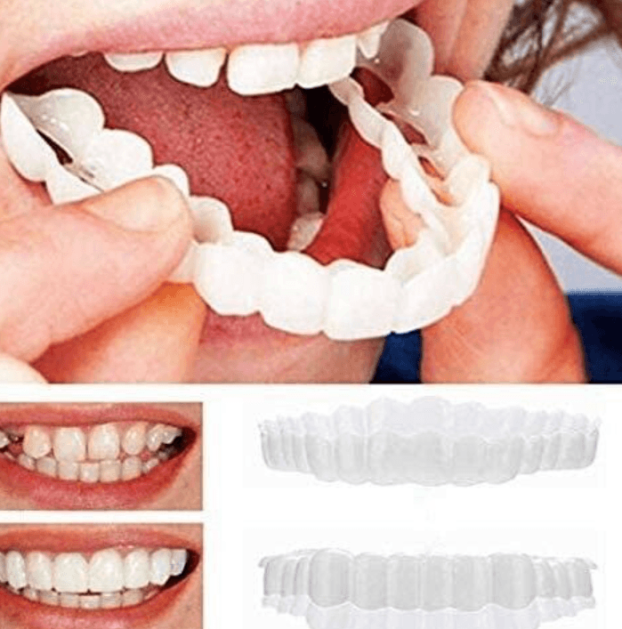 Adjustable Snap-On Dentures