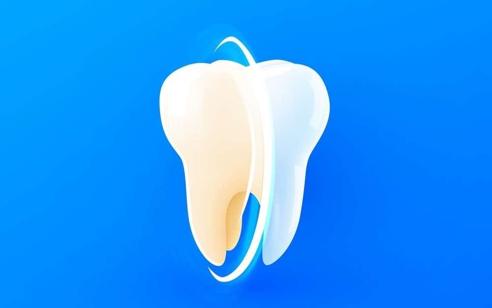 Teeth whitening before and after