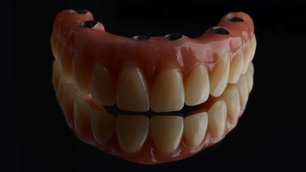 Affordable dentures implants