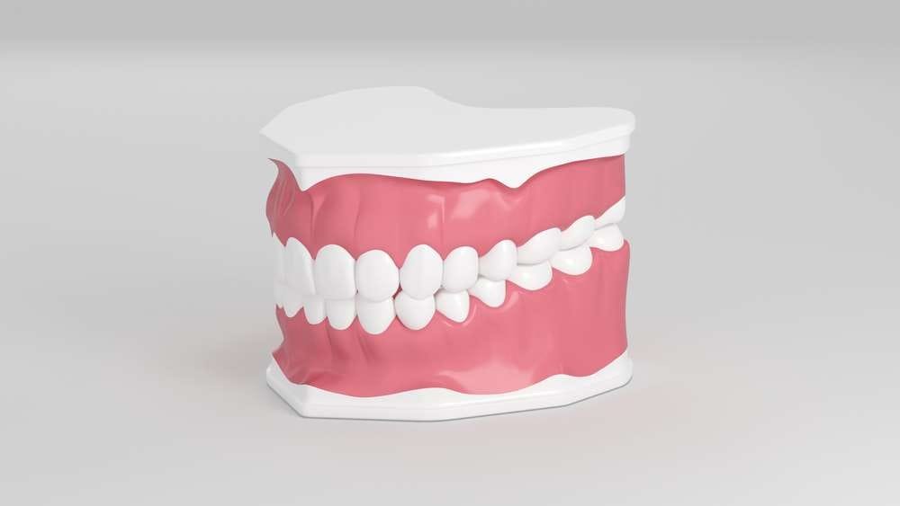 how long should dentures last