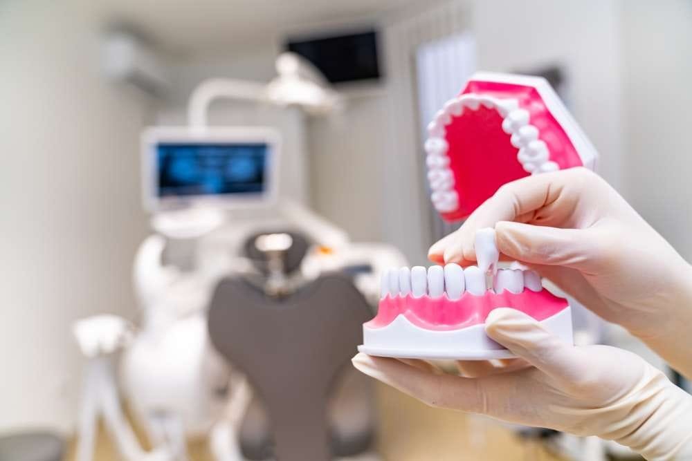 what do partial dentures look like