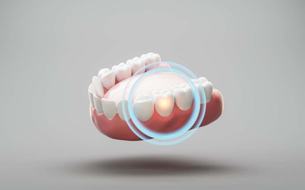 what do bottom dentures look like