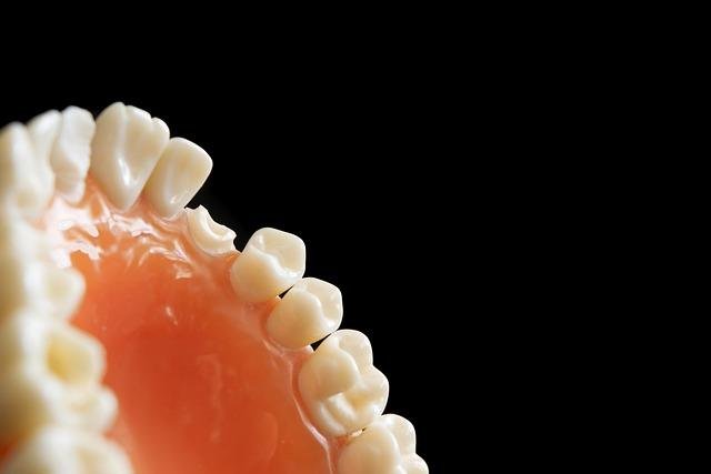 Caring for a new dental bridge in Richmond Hill